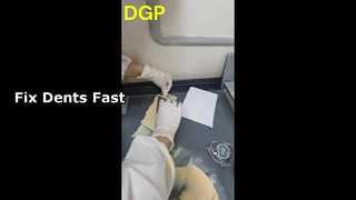 বডি ফিলার